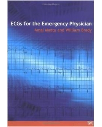 ECG's for the Emergency Physician 1