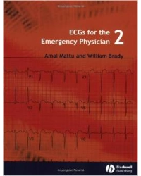 ECGs for the Emergency Physician 2